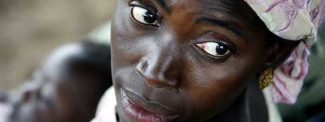 Genitalverstümmelung bei Frauen in Afrika
