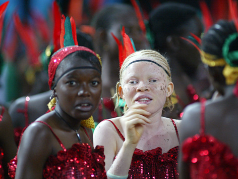Afrikanische Mädchen bei einem Fest, eines davon Albino