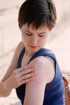 Eine junge Frau kontrolliert rote Flecken auf ihrem Arm