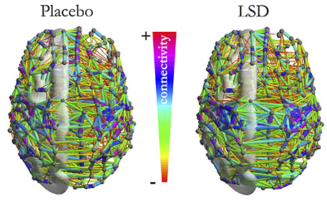 Grafik: unterschiedliche Vernetzung im Gehirn von LSD-Probanden und Placebo-Vergleich