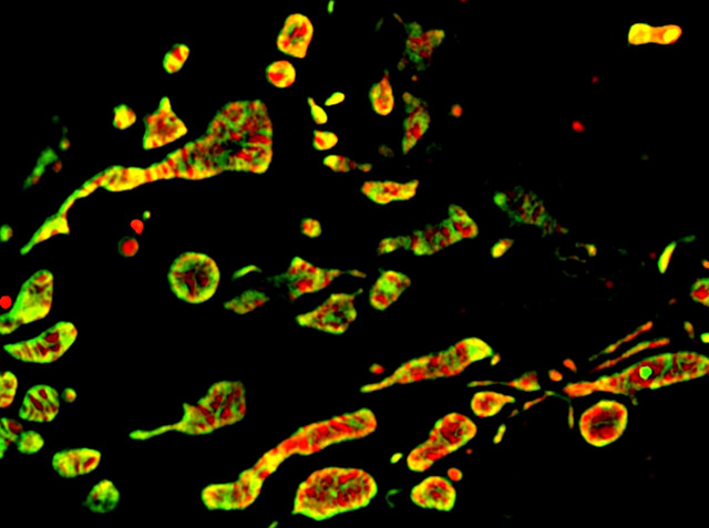Das Innere der Mitochondrien