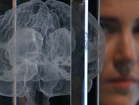 Kunstprojekt: Lasersimulation eines Gehirnscans