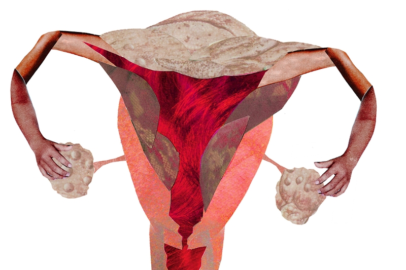 Bild einer Gebärmutter, Collage