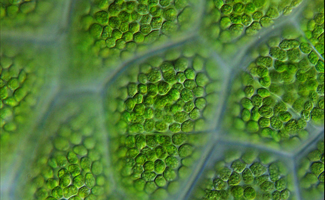 Pflanzenzellen mit grünen Plastiden