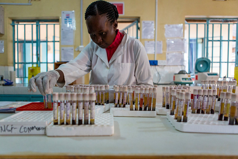 Kenia: Junge Frau untersucht Blutproben