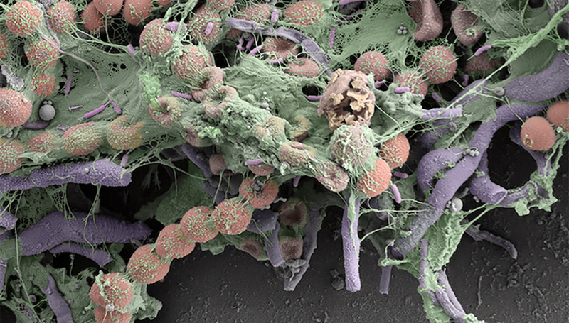 Biofilm aus einer Bade-Ente unter dem Rasterelektronenmikroskop. Die künstliche Einfärbung hebt die verschiedenen Strukturen der Bakterien hervor.