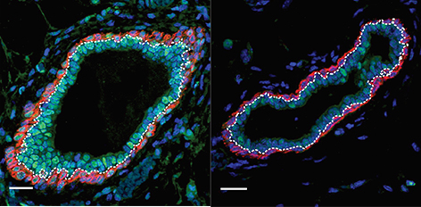 Brustgewebe, in dem gerade viele neue Zellen gebildet werden (links) bzw. das durch Decitabin nahezu inaktiv ist (rechts).