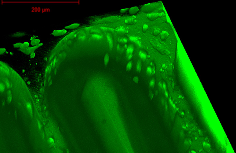 Unter dem Mikroskop: die winzigen Strukturen aus bio-kompatiblem Material