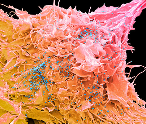 HIV infizierte (blaue Punkte) Zelle