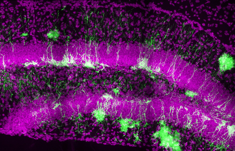 Mikroskop-Aufnahmen der Neuronen produzierenden Stammzellen (grün) im Gehirn erwachsener Mäuse