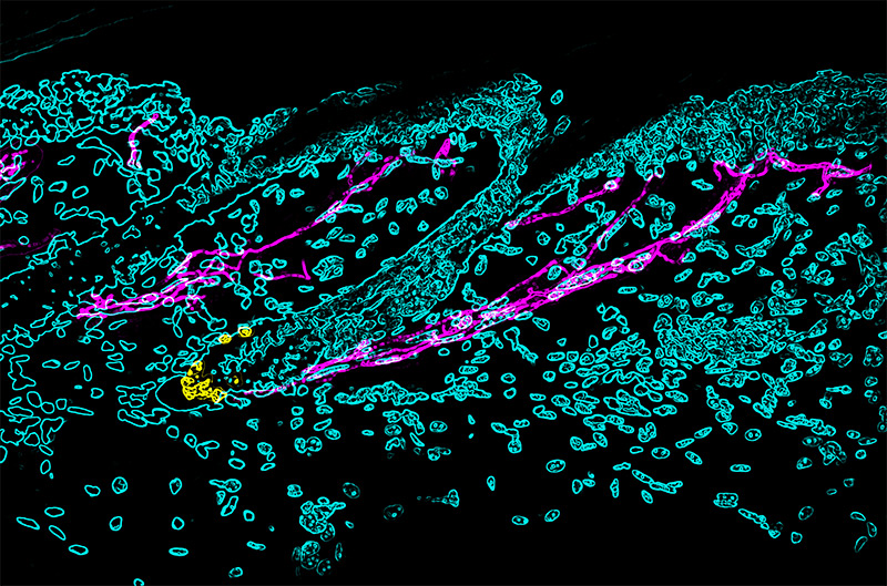 Haar-Stammzellen und Nervenauswüchse unter dem Mikroskop