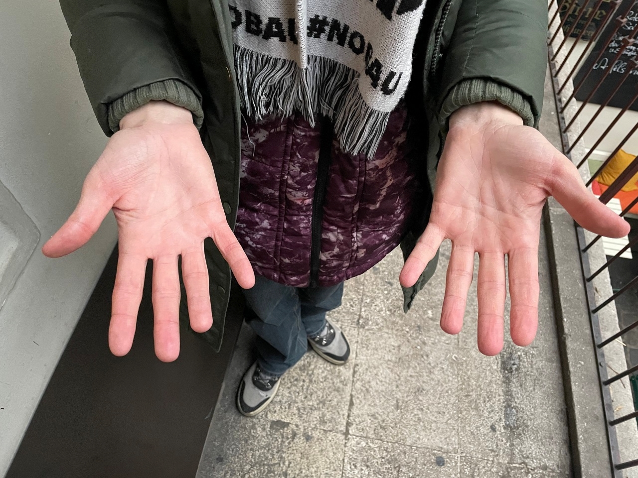Aktivistin Martha Krumpeck zeigt ihre Handflächen, die vom Superkleber keinen Schaden genommen haben